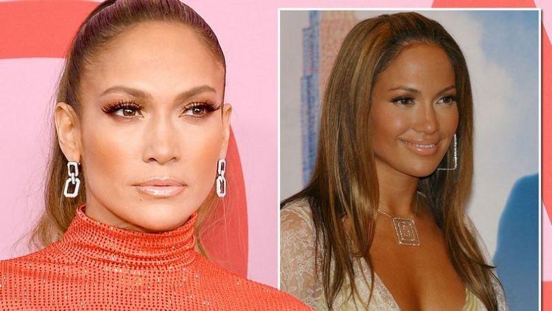 Ahli Bedah Kosmetik: J-Lo Lakukan Operasi Hidung dan Payudara