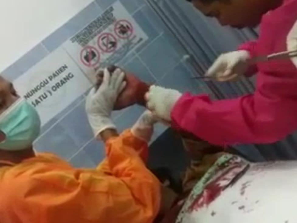 Duel Berdarah Di Sreseh Kabupaten Sampang, Dilarikan Ke RSUD Bangkalan