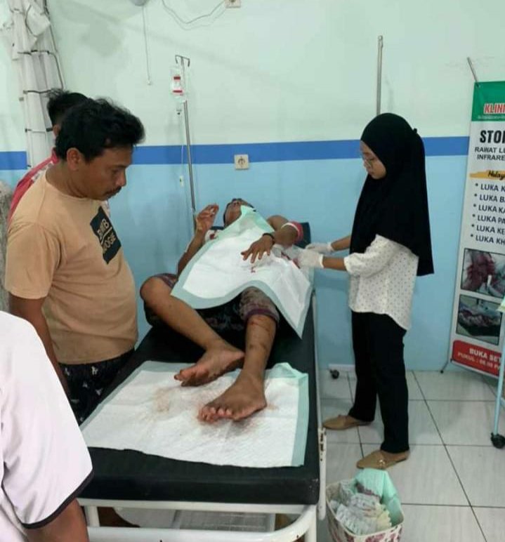 Nahas, Pria Di Banyuates Alami Luka Robek Akibat Sabetan Celurit, Dari Sekelompok Orang