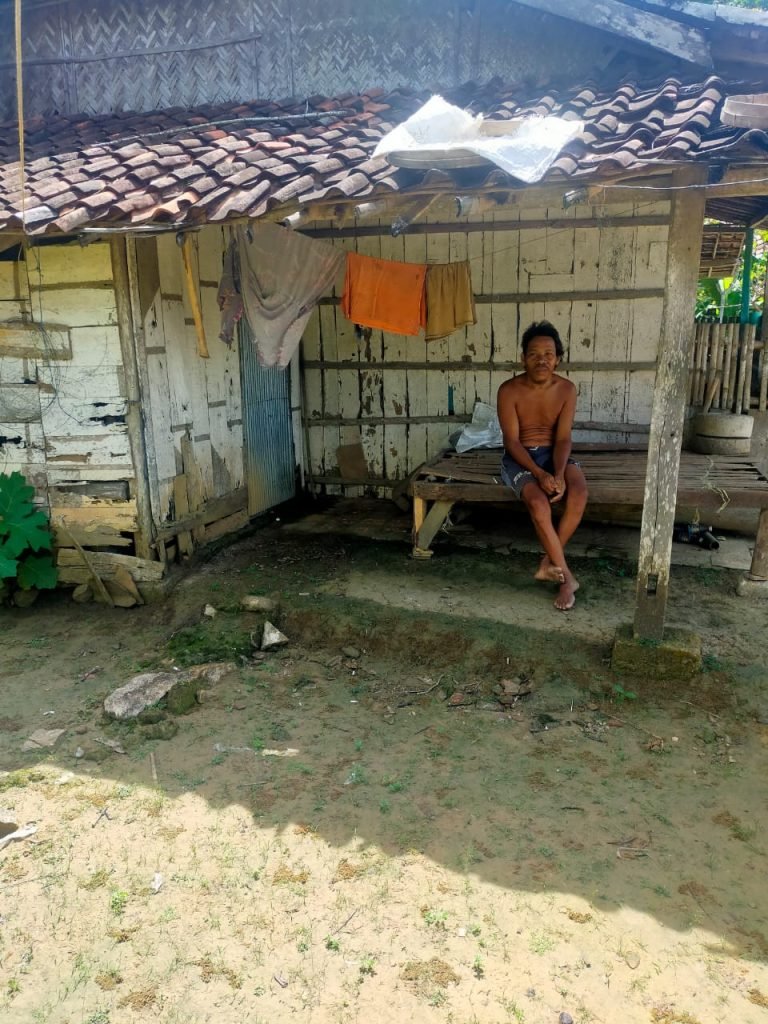 Suami Pincang dan Istri Buta di Desa Torjunan Sampang, Membutuhkan Sentuhan Pemerintah