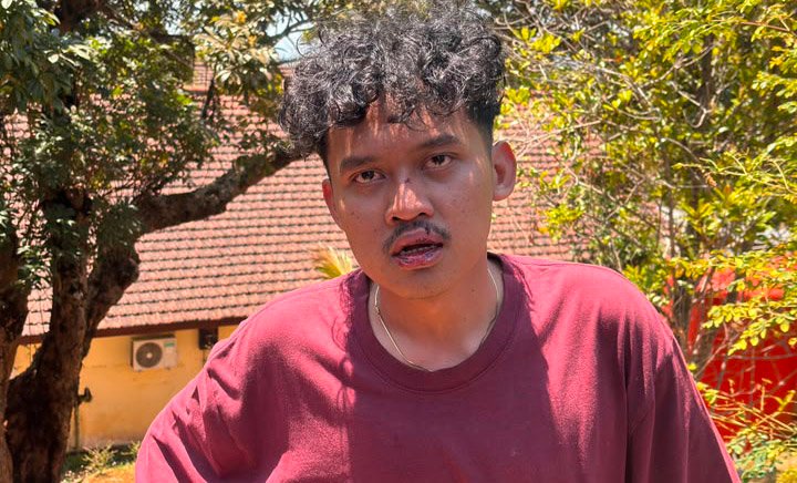 Demi Muluskan Jagoan Elit, Ketua GMNI Jember Babak Belur Dianiaya Pimpinan Sidang Pakai Batu